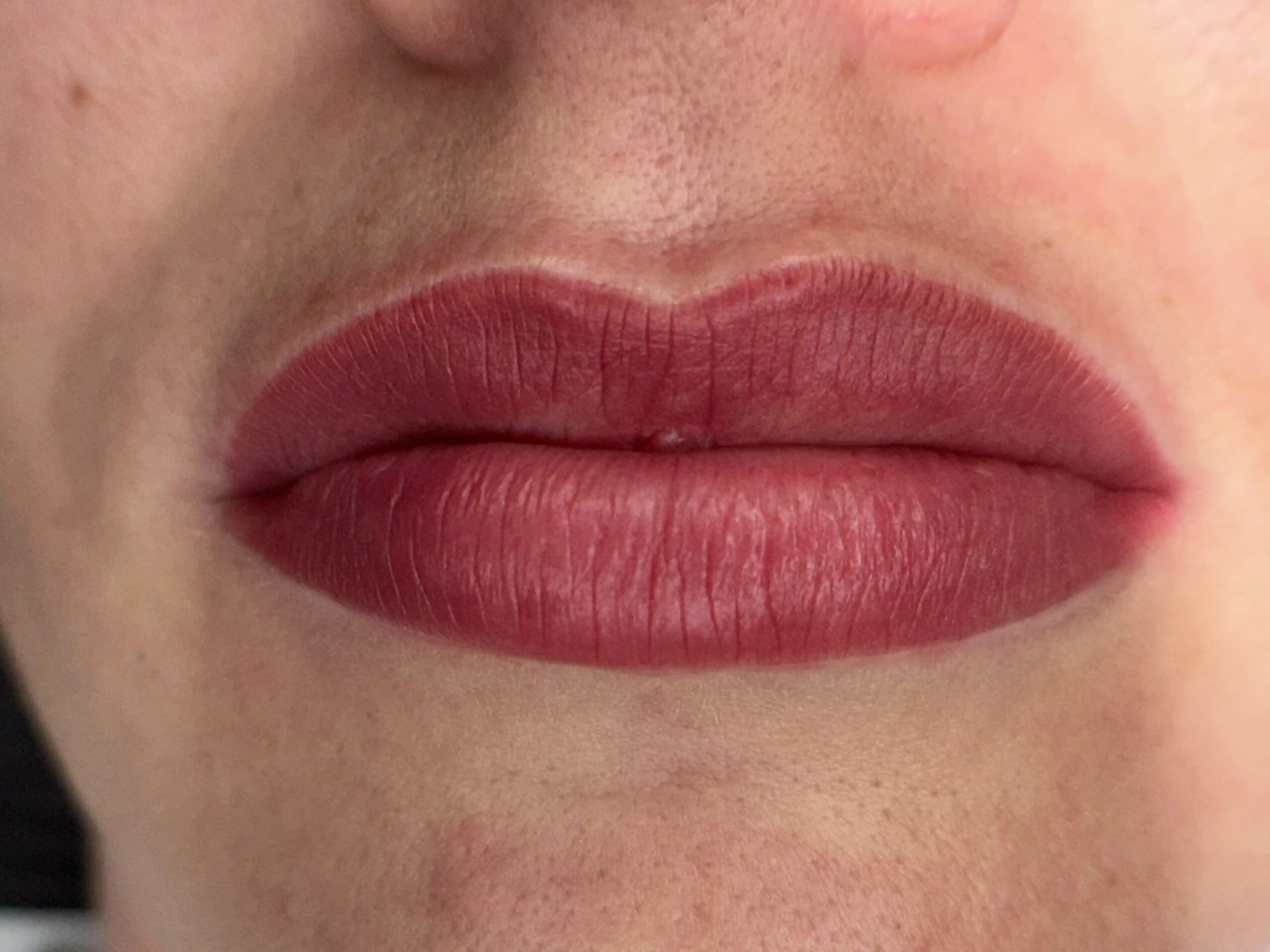 Nachher – Sensual Lips