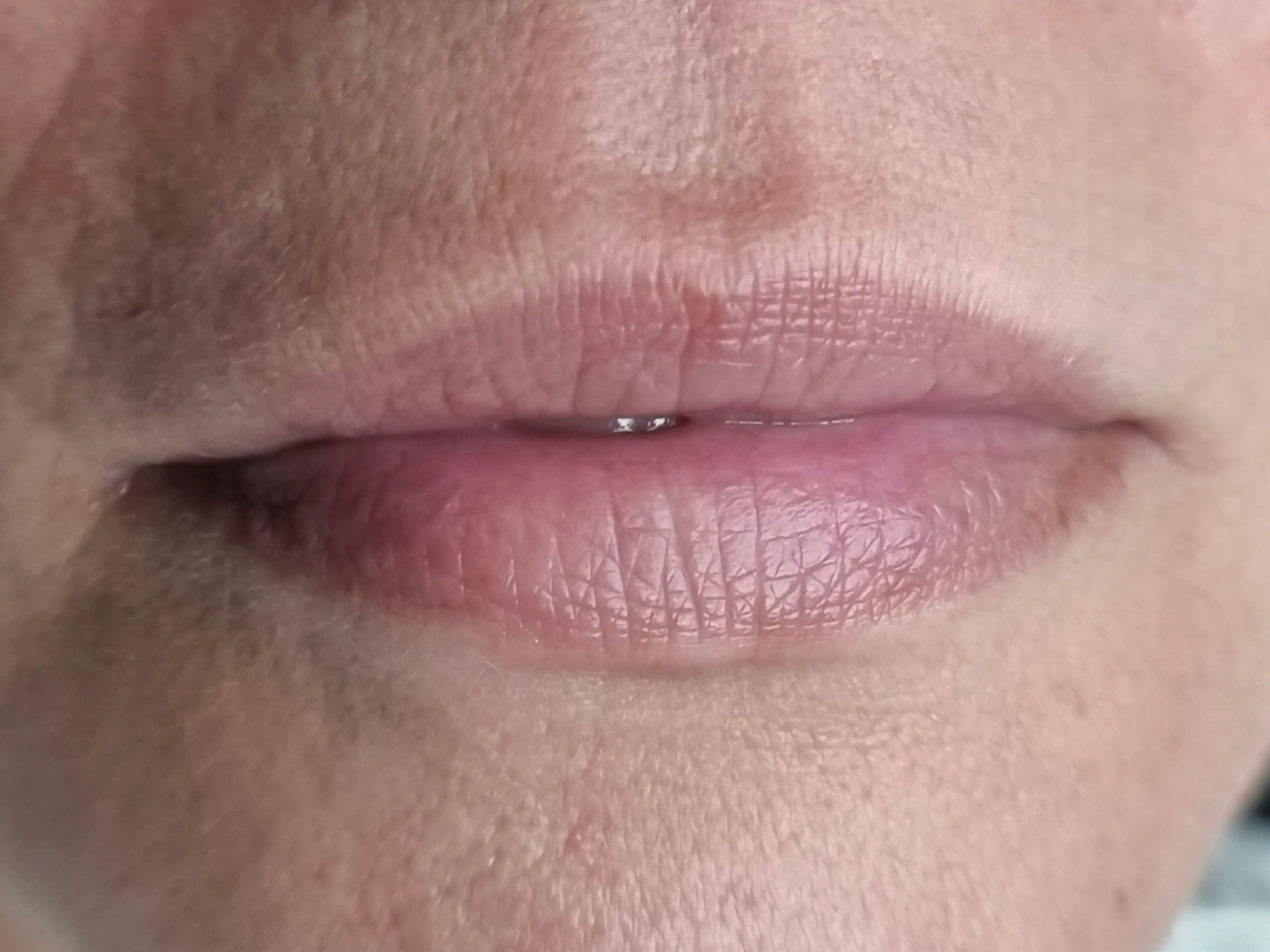 Vorher – Lippenpigmentierung